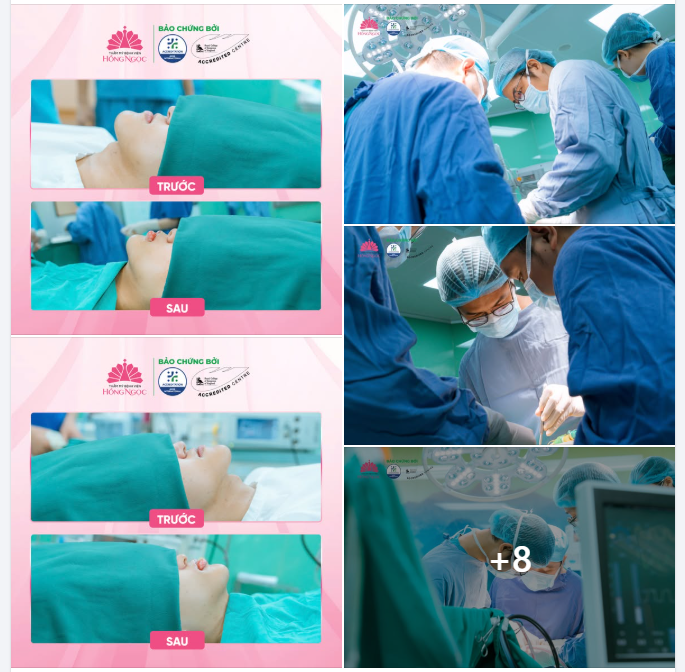 SAU KỲ THI ĐẠI HỌC, NAM SINH 18 TUỔI QUYẾT ĐỊNH PT CHỈNH HÀM ĐỂ THAY ĐỔI DIỆN MẠO, SẴN SÀNG TỰ TIN CHO CHẶNG ĐƯỜNG MỚI