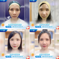 HẠ GÒ MÁ NỘI SOI 4K - KẾT QUẢ THAY ĐỔI NGOẠN MỤC