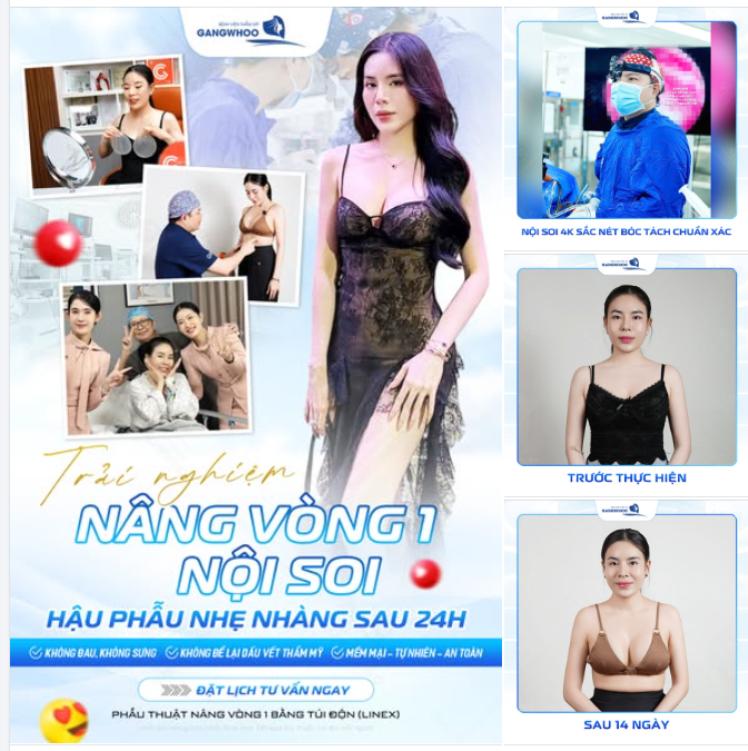 TRẢI NGHIỆM NÂNG VÒNG 1 NỘI SOI, HẬU PHẪU NHẸ NHÀNG SAU 24H