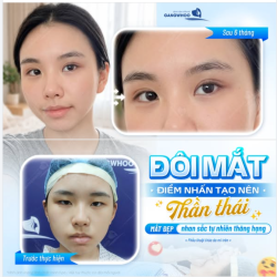 MẮT ĐẸP – NHAN SẮC TỰ NHIÊN THĂNG HẠNG