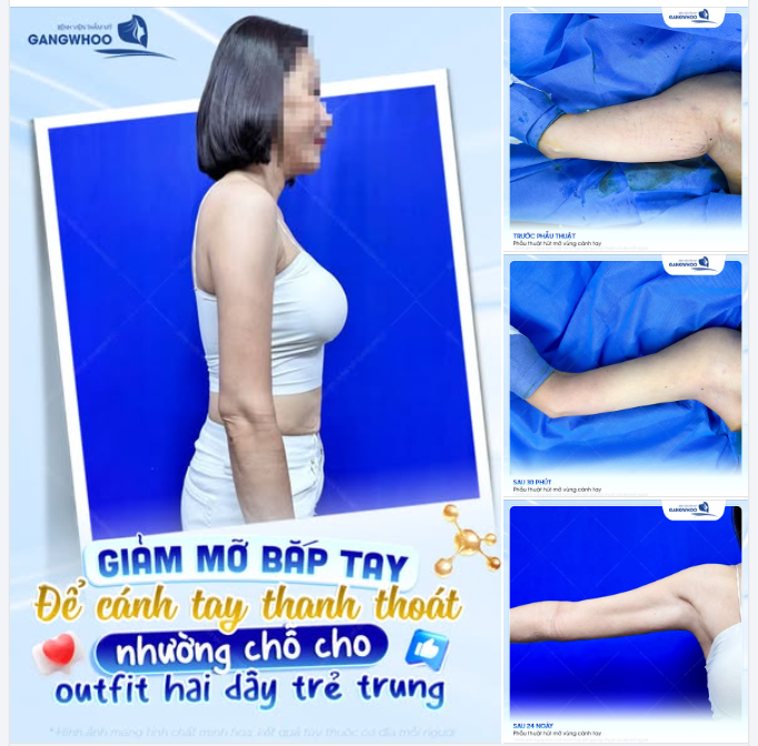 TỰ TIN DIỆN OUTFIT HAI DÂY TRẺ TRUNG