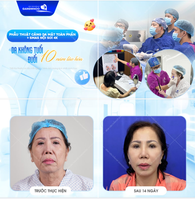 DA KHÔNG TUỔI ĐUỔI 10 NĂM THANH XUÂN