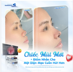KHI CHIẾC MŨI MỚI LÀ TÂM ĐIỂM CUỐN HÚT HƠN