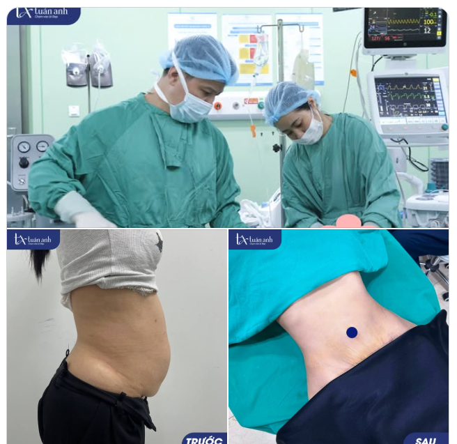 ĐẶC QUYỀN KIẾN TẠO VÓC DÁNG: LÀM 1 ĐƯỢC 4!