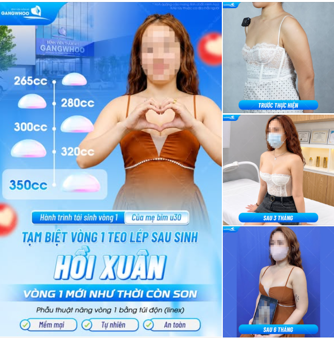 HÀNH TRÌNH TÁI SINH VÒNG 1 CỦA MẸ BỈM U30 - TẠM BIỆT VÒNG 1 TEO LÉP SAU SINH, TỰ TIN HỒI XUÂN VÒNG 1 MỚI NHƯ THỜI CÒN SON