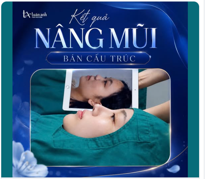 CHIẾM TRỌN "SPOTLIGHT" CHỈ VỚI MỘT GÓC NGHIÊNG CUỐN HÚT