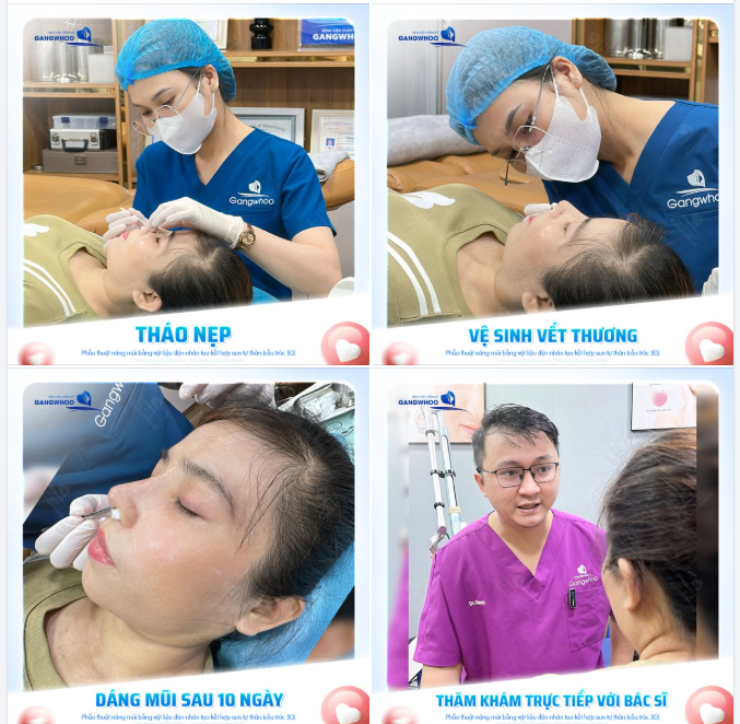 THÁO NẸP ÊM RU - GIAO DIỆN LÊN HƯƠNG