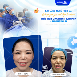 KHI CÔNG NGHỆ HIỆN ĐẠI GIÚP GIỮ GÌN NÉT ĐẸP TỰ NHIÊN