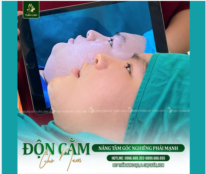 ĐỘN CẰM NAM – THAY ĐỔI NHỎ, KHÁC BIỆT CẢ THẦN THÁI