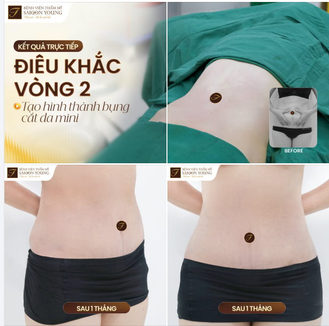CÂN CHỈNH VÒNG 2 GỌN GÀNG CHO MẸ SAU SINH