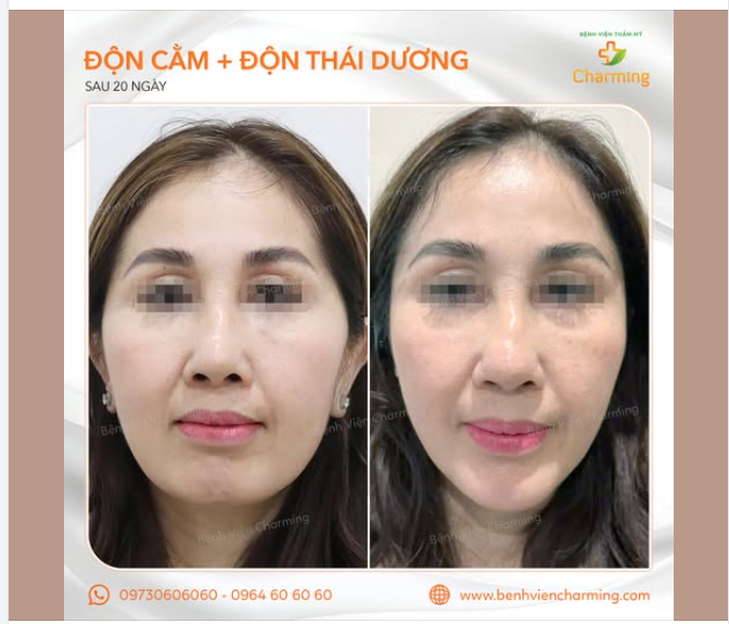 THÁI DƯƠNG HÕM, CẰM NGẮN: ĐÂU LÀ GIẢI PHÁP CỨU CÁNH TỐI ƯU?