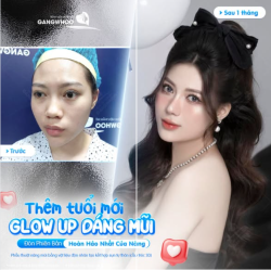 THÊM TUỔI MỚI - GLOW UP DÁNG MŨI MỚI
