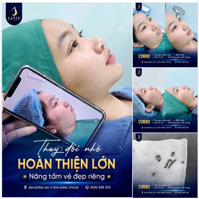 Vẻ đẹp hoàn hảo không đến từ sự phô trương, mà đến từ những “điểm chạm” tinh tế.