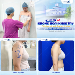 MÙA HÈ KHÔNG NGẠI KHOE TAY – TỰ TIN DIỆN ĐẦM HAI DÂY