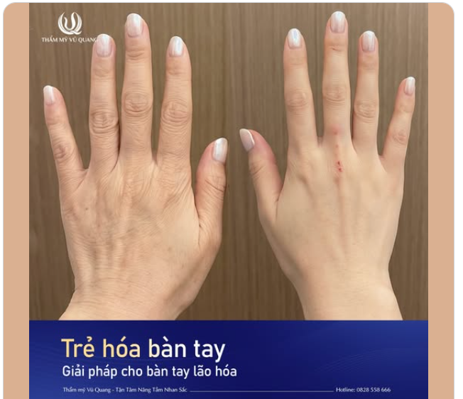 ĐỪNG ĐỂ ĐÔI BÀN TAY TIẾT LỘ TUỔI THẬT CỦA BẠN!