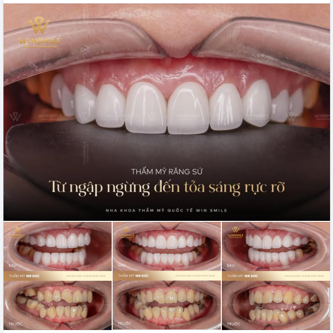Khoảng cách giữa sự tự ti và khoảnh khắc bừng sáng đôi khi chỉ gói gọn trong một quyết định tháo gỡ những khuyết điểm vốn dĩ không đáng có trên đôi môi