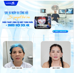 SAU 14 NGÀY AI CŨNG HỎI BÍ QUYẾT TRẺ RA