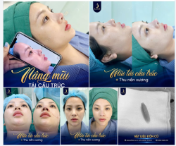 Điểm khác biệt giữa một chiếc mũi "cao" và một chiếc mũi "đẹp" nằm ở cách các đường nét được cân chỉnh hài hòa với gương mặt.