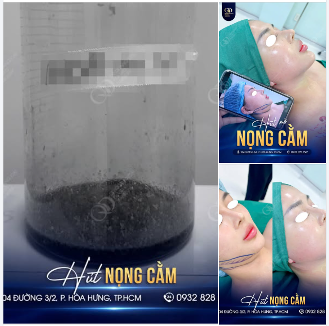 Không phải lúc nào gương mặt nhìn kém gọn cũng do “mặt to”.