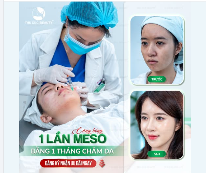 LỰA CHỌN TIÊM MESO CĂNG BÓNG TẠI THU CÚC