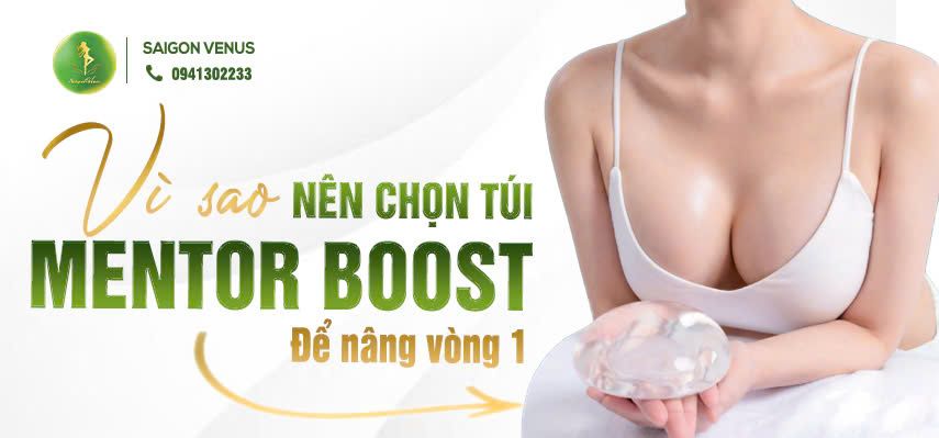 VÌ SAO NÊN CHỌN TÚI MENTOR BOOST ĐỂ NÂNG V1?