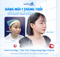 DÁNG MŨI 1 THÁNG TUỔI SẼ NHƯ THẾ NÀO?