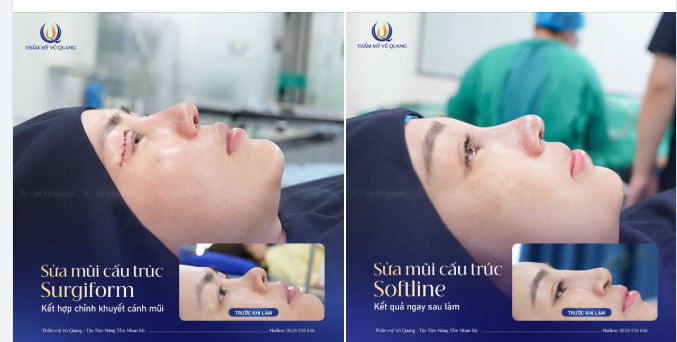 60 PHÚT GIẢI CỨU MŨI HỎNG – TÁI CẤU TRÚC NGAY SAU LÀM
