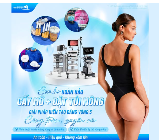 COMBO HOÀN HẢO CẤY MỠ + ĐẶT TÚI MÔNG - GIẢI PHÁP KIẾN TẠO DÁNG VÒNG 3 CĂNG TRÀN, QUYẾN RŨ