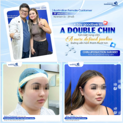 Nữ khách Úc sở hữu một đường viền hàm sắc nét và góc nghiêng thanh tú luôn là mong muốn của nhiều phái đẹp.