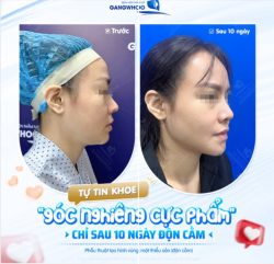 TỰ TIN KHOE "KHOE GÓC NGHIÊNG CỰC PHẨM"