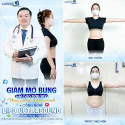 NÂNG CẤP VÓC DÁNG SAU SINH: KHI MẸ BỈM CHỌN YÊU THƯƠNG CHÍNH MÌNH