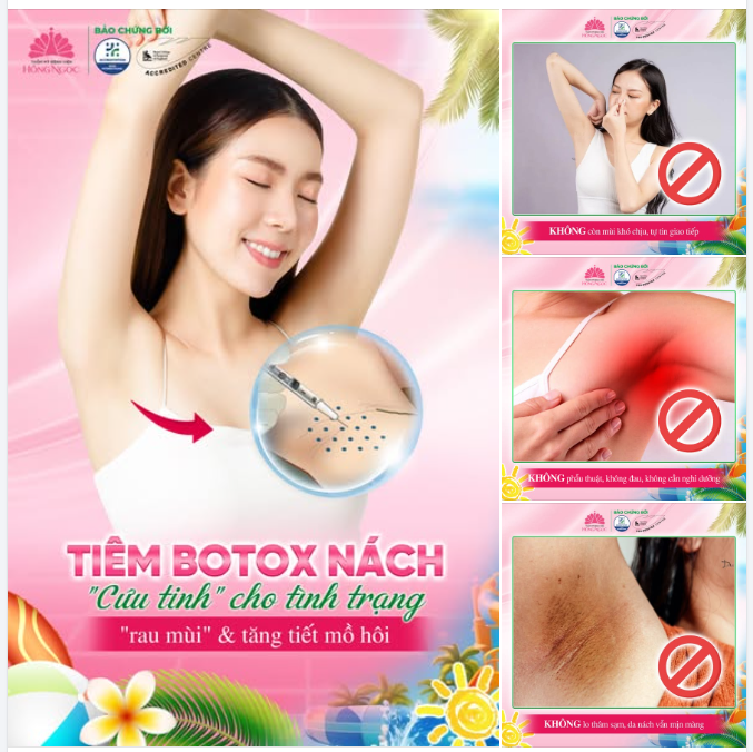 TIÊM BOTOX NÁCH - "CỨU TINH" CHO TÌNH TRẠNG "RAU MÙI"  TĂNG TIẾT MỒ HÔI