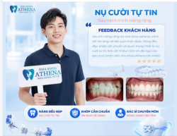 KHÁCH HÀNG NÓI GÌ SAU NGÀY THÁO NIỀNG TẠI ATHENA?