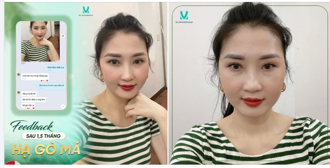 TRẺ RA CẢ CHỤC TUỔI NHỜ GƯƠNG MẶT THANH THOÁT