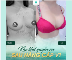 KHE KHÍT QUYẾN RŨ SAU NÂNG CẤP V1