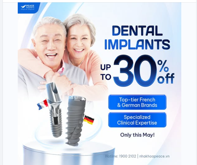 TRỒNG RĂNG IMPLANT TIẾT KIỆM ĐẾN 30% – THỜI ĐIỂM PHỤC HỒI RĂNG MẤT