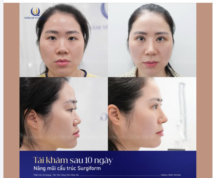 MÀN "LỘT XÁC" CỦA CÔ NÀNG ĐIỀU DƯỠNG TRỞ VỀ TỪ ĐỨC!