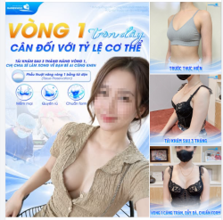VÒNG 1 TRÒN ĐẦY, CÂN ĐỐI VỚI TỶ LỆ CƠ THỂ - TÁI KHÁM SAU 3 THÁNG NÂNG VÒNG 1, CHỊ CHIA SẺ LÀM XONG VỀ BẠN BÈ AI CŨNG KHEN
