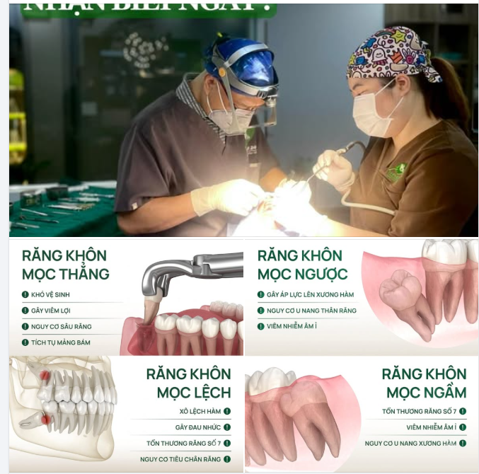 ĐAU RĂNG KHÔN? NHẬN BIẾT NGAY KẺO TIỀN MẤT TẬT MANG!