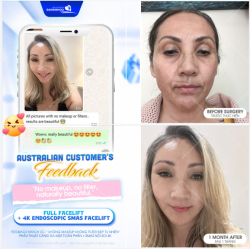 FEEDBACK KHÁCH ÚC: " KHÔNG MAKEUP KHÔNG FILTER ĐẸP TỰ NHIÊN"