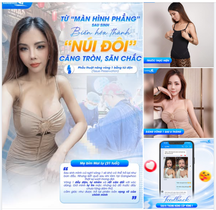 TỪ “MÀN HÌNH PHẲNG” SAU SINH -BIẾN HÓA THÀNH “NÚI ĐÔI” CĂNG TRÒN, SĂN CHẮC