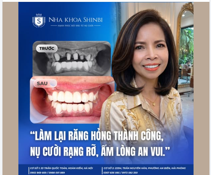 TỪ HÀM RĂNG KHẤP KHỂNH, MẤT NHIỀU VỊ TRÍ ĐẾN NỤ CƯỜI TRỌN VẸN — CHỈ TRONG VÀI NGÀY VỀ NƯỚC