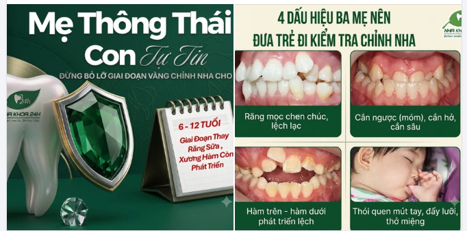 ĐỪNG BỎ LỠ "GIAI ĐOẠN VÀNG" CHỈNH NHA CHO BÉ!