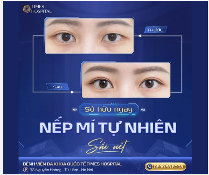 SỞ HỮU NGAY NẾP MÍ ĐẸP TỰ NHIÊN  BÍ QUYẾT NẰM Ở ĐÂU?