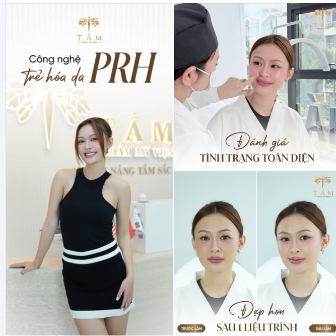 PRH là liệu pháp trẻ hóa đa tầng hiện đại, giúp cải thiện toàn diện từ chất lượng làn da đến đường nét gương mặt.
