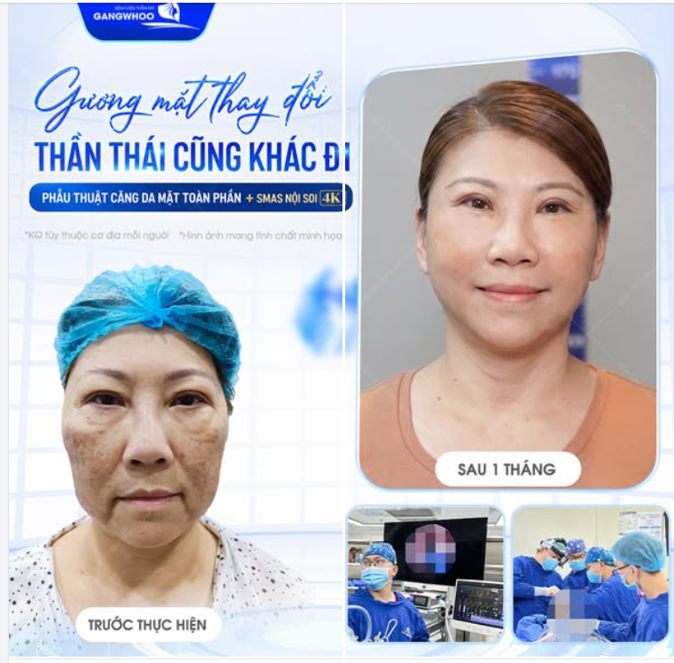 https://suckhoe123.vn/lam-dep/cang-da-mat/