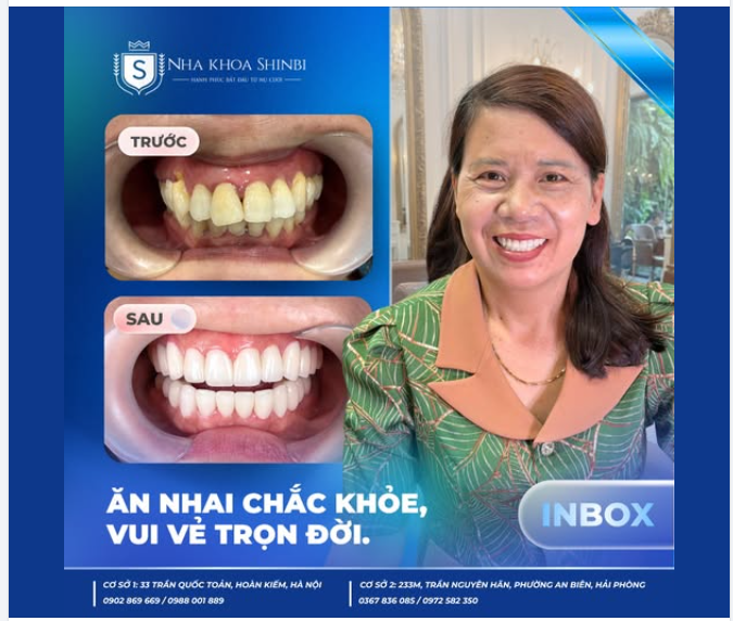 HẠNH PHÚC CHƯA BAO GIỜ LÀ MUỘN ĐỂ BẮT ĐẦU VỚI MỘT NỤ CƯỜI MỚI!