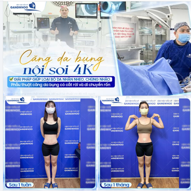 GIẢI PHÁP LOẠI BỎ DA NHĂN NHEO, CHÙNG NHÃO