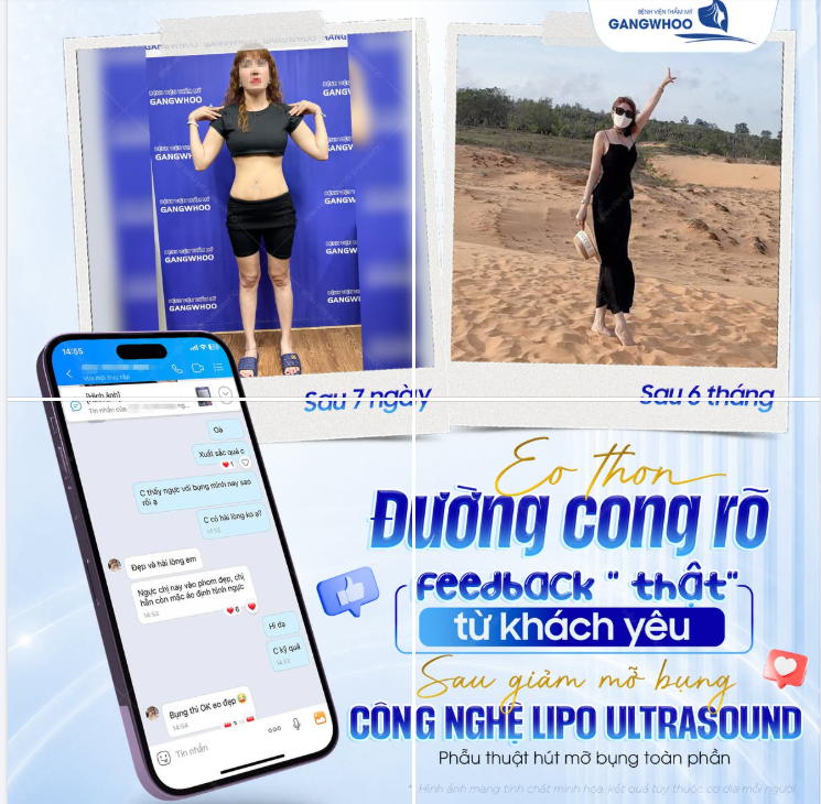 EO THON - ĐƯỜNG CONG RÕ