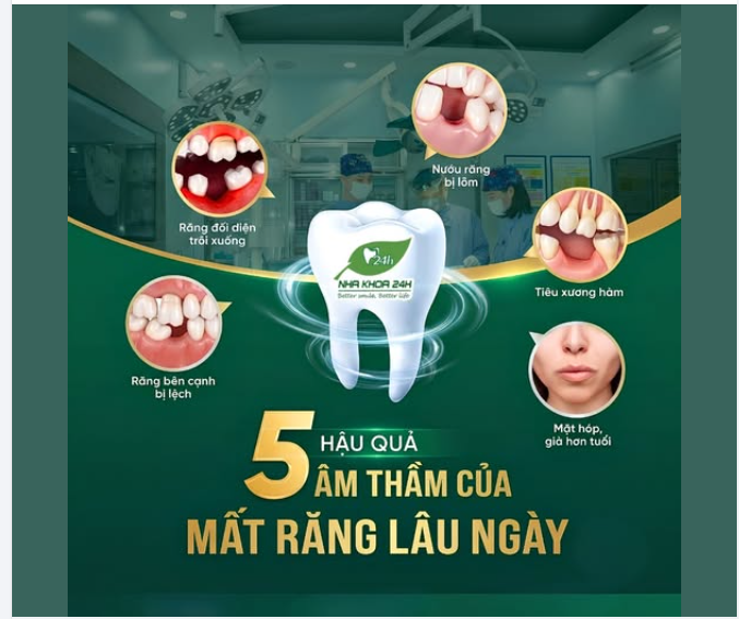 MẤT 1 RĂNG = MẤT LUÔN CẢ NỤ CƯỜI KHUÔN MẶT?